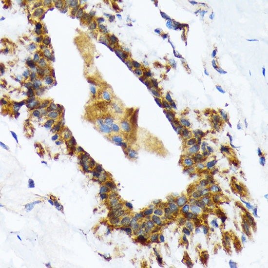 RAIDD/CRADD Rabbit mAb