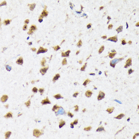 eIF2B epsilon (EIF2B5) Rabbit mAb