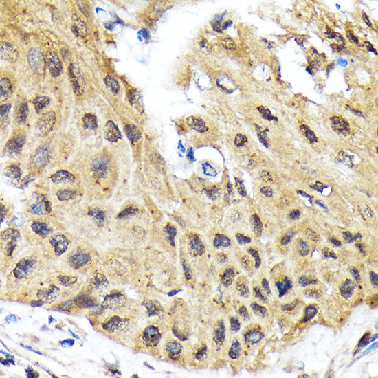 eIF2B epsilon (EIF2B5) Rabbit mAb