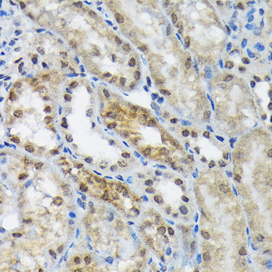 eIF2B epsilon (EIF2B5) Rabbit mAb