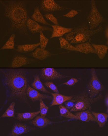 eIF2B epsilon (EIF2B5) Rabbit mAb