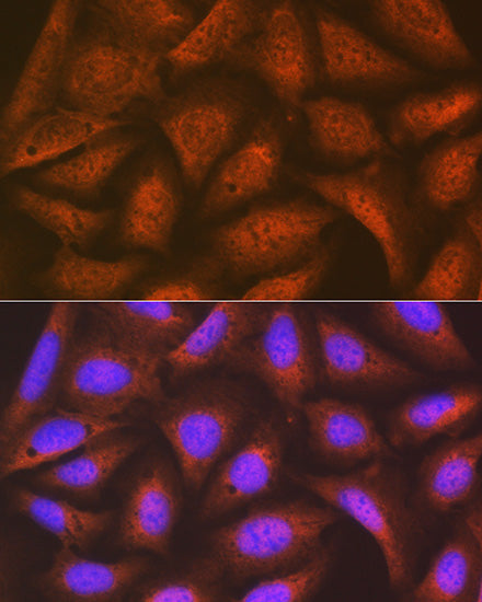 eIF2B epsilon (EIF2B5) Rabbit mAb