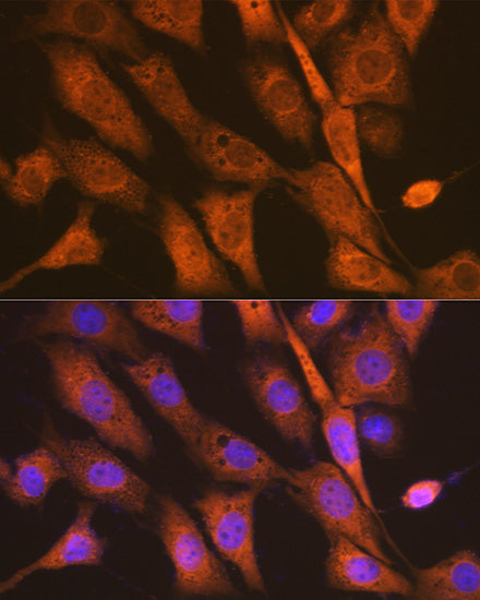 PEN2/PSENEN Rabbit mAb