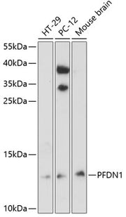 PFDN1 Rabbit pAb