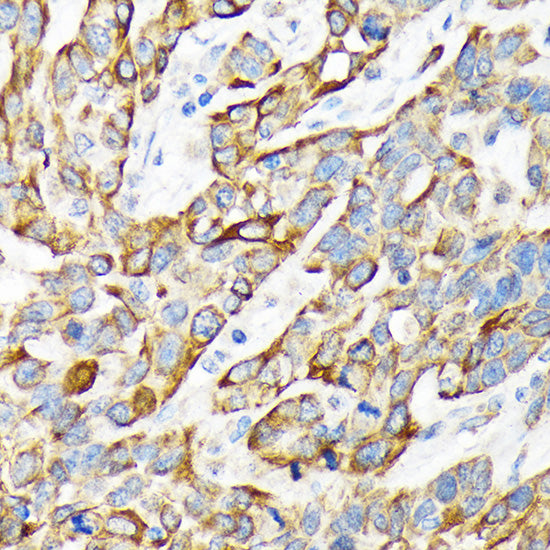 Cytokeratin 16 (KRT16) Rabbit mAb