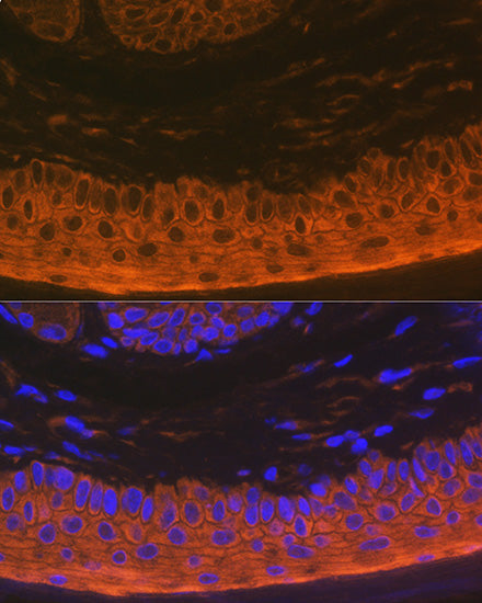 Cytokeratin 16 (KRT16) Rabbit mAb