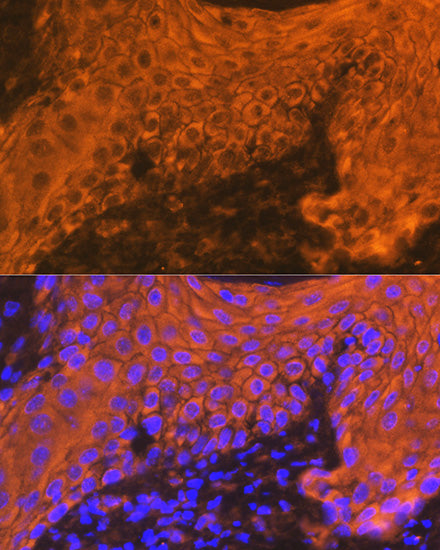 Cytokeratin 16 (KRT16) Rabbit mAb