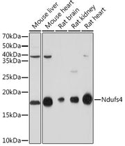 NDUFS4 Rabbit mAb