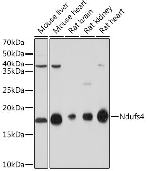 NDUFS4 Rabbit mAb