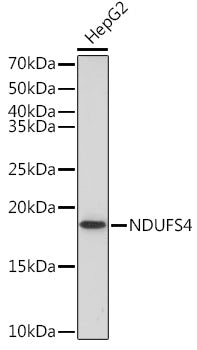 NDUFS4 Rabbit mAb