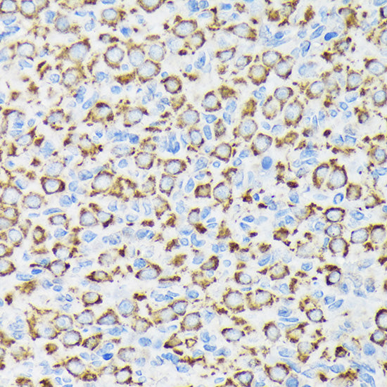 NDUFS4 Rabbit mAb