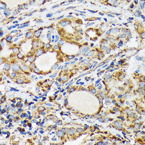 NDUFS4 Rabbit mAb