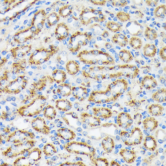 NDUFS4 Rabbit mAb