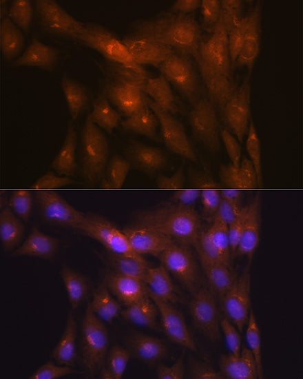NDUFS4 Rabbit mAb