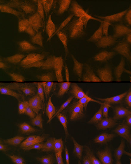 FXR1 Rabbit mAb