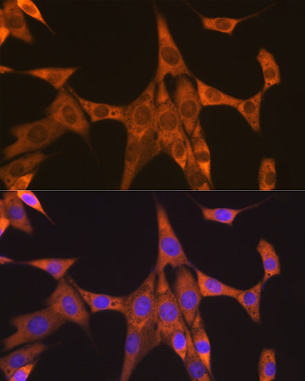 FXR1 Rabbit mAb