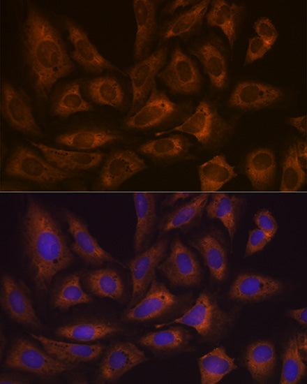 FXR1 Rabbit mAb