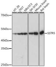 SSTR5 Rabbit mAb
