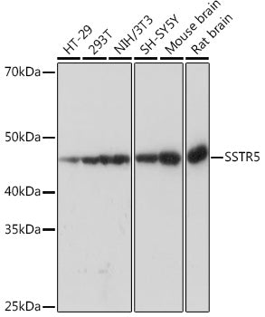 SSTR5 Rabbit mAb