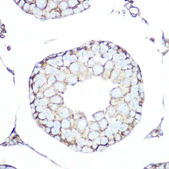 SSTR5 Rabbit mAb