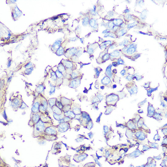 SSTR5 Rabbit mAb