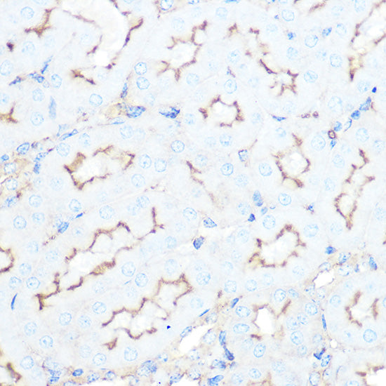 SSTR5 Rabbit mAb