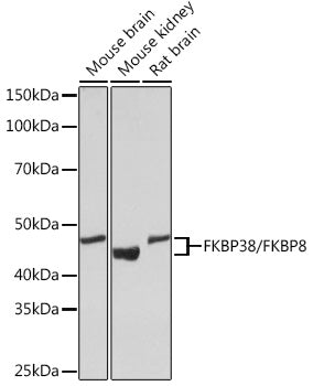 FKBP38/FKBP8 Rabbit mAb