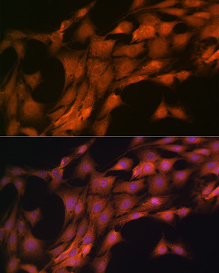 FKBP38/FKBP8 Rabbit mAb
