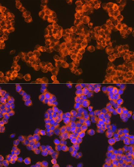 Oncostatin M Rabbit mAb