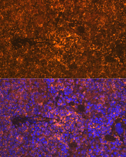 Oncostatin M Rabbit mAb