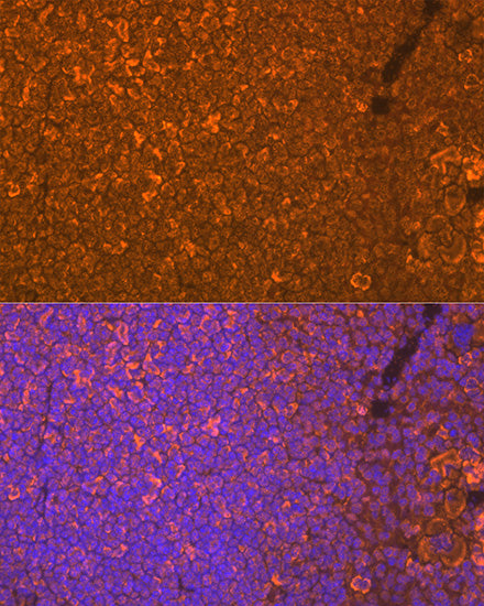 Oncostatin M Rabbit mAb