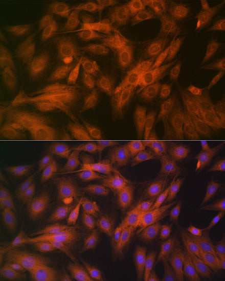 Calpain 1 Rabbit mAb