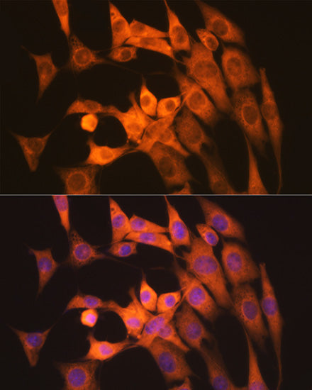 Calpain 1 Rabbit mAb