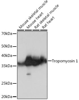Tropomyosin 1 Rabbit mAb