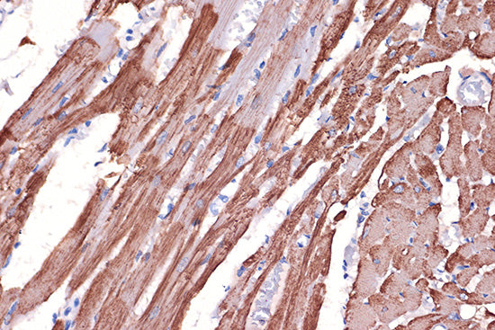 Tropomyosin 1 Rabbit mAb