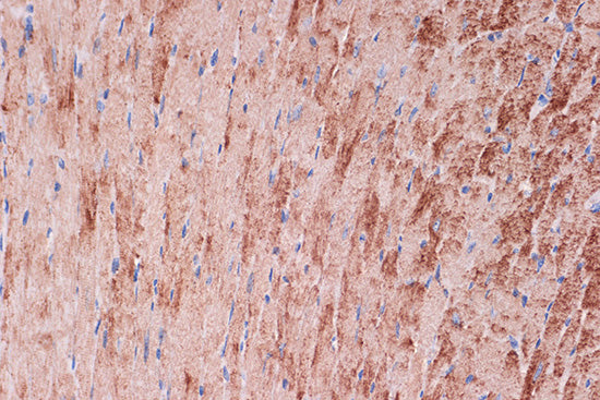 Tropomyosin 1 Rabbit mAb