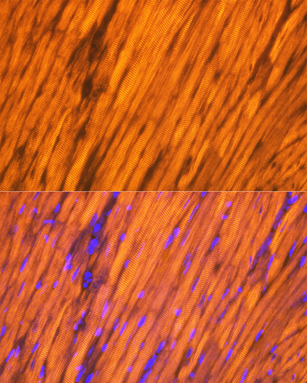 Tropomyosin 1 Rabbit mAb