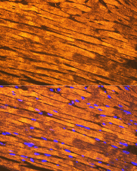 Tropomyosin 1 Rabbit mAb