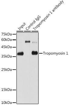 Tropomyosin 1 Rabbit mAb