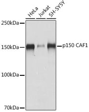 p150 CAF1 Rabbit mAb