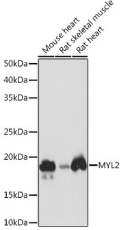 MYL2 Rabbit mAb
