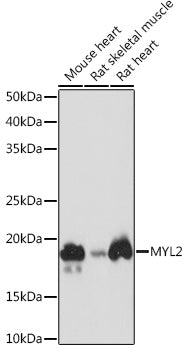 MYL2 Rabbit mAb