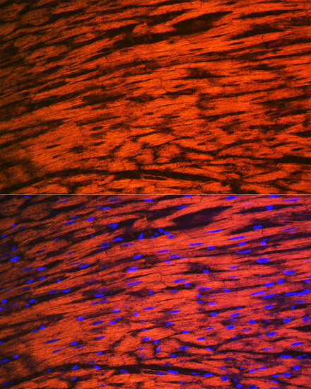 MYL2 Rabbit mAb