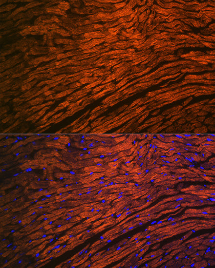 MYL2 Rabbit mAb