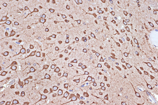 eEF1G Rabbit mAb