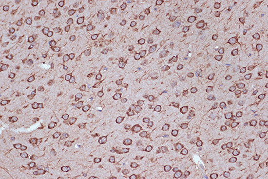 eEF1G Rabbit mAb