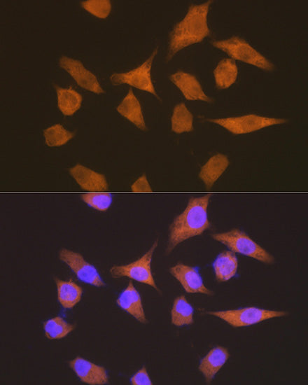 eEF1G Rabbit mAb