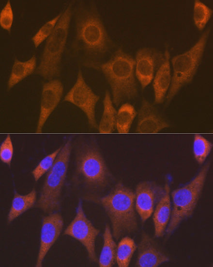 eEF1G Rabbit mAb