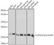 [KD Validated] CDKN2C/p18-INK4C Rabbit mAb