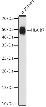 HLA B7 Rabbit mAb